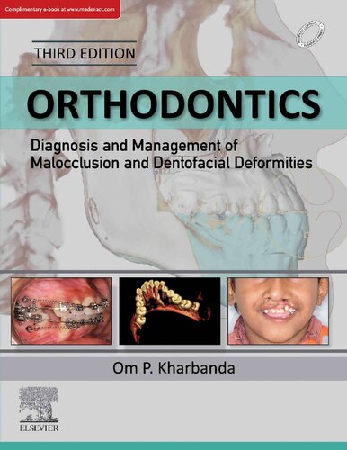 Ebook – Orthodontics: Diagnosis And Management Of Malocclusion And ...