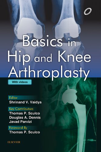 Ebook – Basics in Hip and Knee Arthroplasty (PDF Instant Download ...