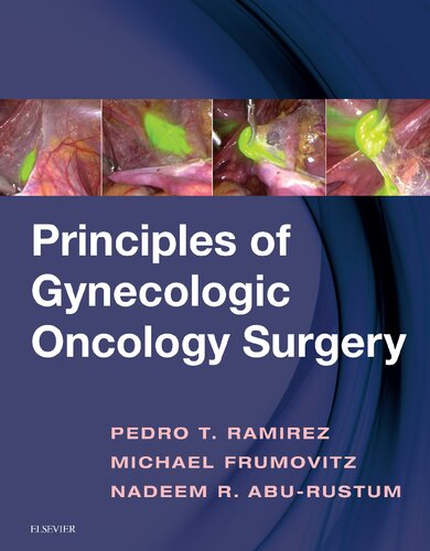 Principles of Gynecologic Oncology Surgery – AttentiveSons Store