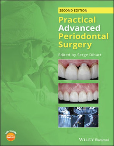 Ebook – Practical Advanced Periodontal Surgery (PDF Instant Download ...