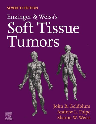 Ebook – Enzinger And Weiss’s Soft Tissue Tumors (PDF Instant Download ...