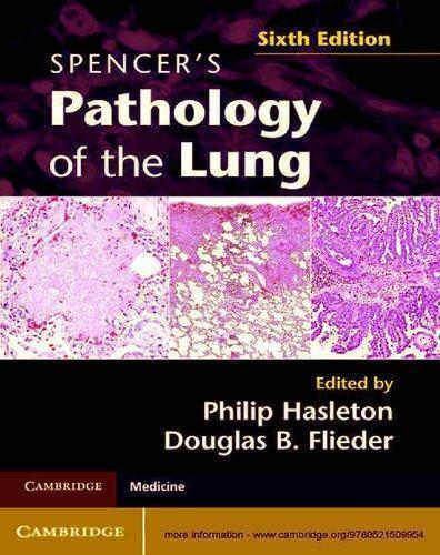 Spencers Pathology Of The Lung 6Th Edition – AttentiveSons Store