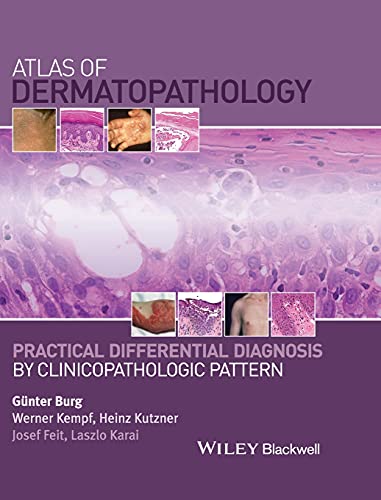 Ebook – Atlas of Dermatopathology: Practical Differential Diagnosis by ...